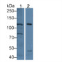 Western Blot; Sample: Lane1: Mouse Kidney lysate; Lane2: Human HepG2 cell lysate; Primary Ab: 1µg/ml Rabbit Anti-Human NPHN Antibody; Second Ab: 0.2µg/mL HRP-Linked Caprine Anti-Rabbit IgG Polyclonal Antibody;