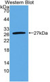 Western Blot; Sample: Recombinant protein.