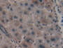 DAB staining on IHC-P; Samples: Human Liver Tissue; Primary Ab: 10µg/ml Rabbit Anti-Human PPARa Antibody Second Ab: 2µg/mL HRP-Linked Caprine Anti-Rabbit IgG Polyclonal Antibody