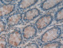 DAB staining on IHC-P; Samples: Human Intestine Tissue; Primary Ab: 20µg/ml Rabbit Anti-Human ITLN1 Antibody Second Ab: 2µg/mL HRP-Linked Caprine Anti-Rabbit IgG Polyclonal Antibody