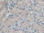 DAB staining on IHC-P; Samples: Mouse Kidney Tissue; Primary Ab: 20µg/ml Rabbit Anti-Mouse PICK1 Antibody Second Ab: 2µg/mL HRP-Linked Caprine Anti-Rabbit IgG Polyclonal Antibody