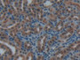 DAB staining on IHC-P; Samples: Rat Kidney Tissue; Primary Ab: 20µg/ml Rabbit Anti-Rat ACP5 Antibody Second Ab: 2µg/mL HRP-Linked Caprine Anti-Rabbit IgG Polyclonal Antibody