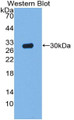 Western Blot; Sample: Recombinant protein.