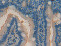 DAB staining on IHC-P; Samples: Mouse Intestine Tissue; Primary Ab: 20µg/ml Rabbit Anti-Mouse ACP5 Antibody Second Ab: 2µg/mL HRP-Linked Caprine Anti-Rabbit IgG Polyclonal Antibody