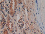 DAB staining on IHC-P; Samples: Human Kidney Tissue; Primary Ab: 10µg/ml Rabbit Anti-Human OPN Antibody Second Ab: 2µg/mL HRP-Linked Caprine Anti-Rabbit IgG Polyclonal Antibody