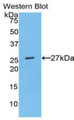 Western Blot; Sample: Recombinant protein.