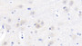 DAB staining on IHC-P; Samples: Porcine Cerebrum Tissue; Primary Ab: 20μg/ml Rabbit Anti-Porcine CST3 Antibody Second Ab: 2µg/mL HRP-Linked Caprine Anti-Rabbit IgG Polyclonal Antibody