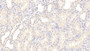 DAB staining on fromalin fixed paraffin-embedded Liver tissue)