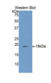 Western Blot; Sample: Recombinant protein.