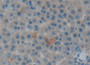 DAB staining on IHC-P; Samples: Rat Liver Tissue; Primary Ab: 20µg/ml Rabbit Anti-Rat SPA Antibody Second Ab: 2µg/mL HRP-Linked Caprine Anti-Rabbit IgG Polyclonal Antibody