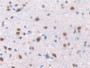 DAB staining on fromalin fixed paraffin- embedded spinal cord tissue)