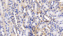 DAB staining on IHC-P; Samples: Mouse Kidney Tissue;  Primary Ab: 20µg/ml Rabbit Anti-Mouse REN Antibody Second Ab: 2µg/mL HRP-Linked Caprine Anti-Rabbit IgG Polyclonal Antibody 