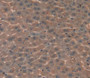 Used in DAB staining on fromalin fixed paraffin- embedded Kidney tissue