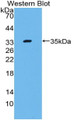 Western Blot; Sample: Recombinant C4, Mouse.