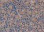 DAB staining on IHC-P; Samples: Mouse Kidney Tissue; Primary Ab: 10µg/ml Rabbit Anti-Mouse C4 Antibody Second Ab: 2µg/mL HRP-Linked Caprine Anti-Rabbit IgG Polyclonal Antibody