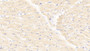 DAB staining on IHC-P; Samples: Human Cardiac Muscle Tissue;  Primary Ab: 20μg/ml Rabbit Anti-Human PDP Antibody Second Ab: 2µg/mL HRP-Linked Caprine Anti-Rabbit IgG Polyclonal Antibody 