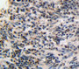 DAB staining on fromalin fixed paraffin-embedded esophagus tissue)