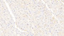 DAB staining on IHC-P; Samples: Human Cardiac Muscle Tissue;  Primary Ab: 20μg/ml Rabbit Anti-Human PPARg Antibody Second Ab: 2µg/mL HRP-Linked Caprine Anti-Rabbit IgG Polyclonal Antibody 