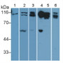 Western Blot; Sample: Lane1: Mouse Adrenal gland lysate; Lane2: Human Placenta lysate; Lane3: U87MG cell lysate; Lane4: Rat Heart lysate; Lane5: Rat Liver lysate; Lane6: Porcine Liver lysate; Primary Ab: 1.5ug/ml Rabbit Anti-Mouse CD26 Antibody; Second Ab: 0.2µg/mL HRP-Linked Caprine Anti-Rabbit IgG Polyclonal Antibody;