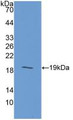 Western Blot; Sample: Recombinant GIP, Human.