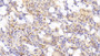 DAB staining on IHC-P; Samples: Human Small intestine Tissue; Primary Ab: 20μg/ml Rabbit Anti-Human GIP Antibody Second Ab: 2µg/mL HRP-Linked Caprine Anti-Rabbit IgG Polyclonal Antibody