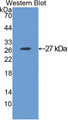 Western Blot; Sample: Recombinant protein.