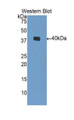 Western Blot; Sample: Recombinant protein.