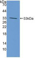 Western Blot; Sample: Recombinant ALK, Human.