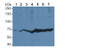 Western Blot; Sample: Lane1: Human Placenta lysate; Lane2: Porcine Heart lysate; Lane3: Porcine Kidney lysate; Lane4: Porcine Liver lysate; Lane5: Rat Placenta lysate; Lane6: Rat Heart lysate; Lane7: Rat Liver lysate; Primary Ab: 3µg/ml Rabbit Anti-Rat NOS3 Antibody; Second Ab: 0.2µg/mL HRP-Linked Caprine Anti-Rabbit IgG Polyclonal Antibody;