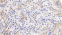 DAB staining on IHC-P. Samples: Human Tissue)