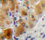 Used in DAB staining on fromalin fixed paraffin-embedded Liver tissue