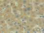 DAB staining on IHC-P; Samples: Human Liver Tissue; Primary Ab: 20µg/ml Rabbit Anti-Human C2 Antibody Second Ab: 2µg/mL HRP-Linked Caprine Anti-Rabbit IgG Polyclonal Antibody