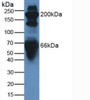 Western Blot; Sample: Human Serum.