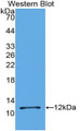 Western Blot; Sample: Recombinant protein.