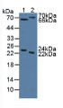 Western Blot; Sample: Lane1: Human Serum; Lane2: Rat Liver Tissue.