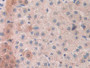 DAB staining on IHC-P; Samples: Human Liver Tissue; Primary Ab: 20µg/ml Rabbit Anti-Human MASP2 Antibody Second Ab: 2µg/mL HRP-Linked Caprine Anti-Rabbit IgG Polyclonal Antibody