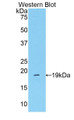 Western Blot; Sample: Recombinant protein.