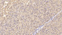 DAB staining on IHC-P; Samples: Human Liver Tissue; Primary Ab: 20µg/ml Rabbit Anti-Human MASP2 Antibody Second Ab: 2µg/mL HRP-Linked Caprine Anti-Rabbit IgG Polyclonal Antibody