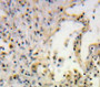 Used in DAB staining on fromalin fixed paraffin-embedded Lung tissue