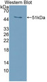 Western Blot; Sample: Recombinant protein.