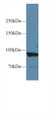 Western Blot; Sample: Human Liver lysate; Primary Ab: 1µg/ml Rabbit Anti-Human PYGL Antibody Second Ab: 0.2µg/mL HRP-Linked Caprine Anti-Rabbit IgG Polyclonal Antibody