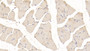 DAB staining on IHC-P; Samples: Mouse Skeletal muscle Tissue; Primary Ab: 20μg/ml Rabbit Anti-Mouse PYGM Antibody Second Ab: 2µg/mL HRP-Linked Caprine Anti-Rabbit IgG Polyclonal Antibody