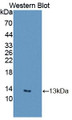 Western Blot; Sample: Recombinant protein.