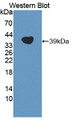 Western Blot; Sample: Recombinant protein.