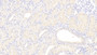 DAB staining on IHC-P; Samples: Human Kidney Tissue; Primary Ab: 20μg/ml Rabbit Anti-Human Lpa Antibody Second Ab: 2µg/mL HRP-Linked Caprine Anti-Rabbit IgG Polyclonal Antibody