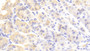 DAB staining on fromalin fixed paraffin-embedded Testis tissue)