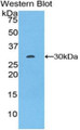 Western Blot; Sample: Recombinant protein.