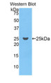 Western Blot; Sample: Recombinant protein.