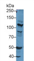 Western Blot; Sample: Rat Cerebrum lysate; Primary Ab: 1µg/ml Rabbit Anti-Rat NOS2 Antibody Second Ab: 0.2µg/mL HRP-Linked Caprine Anti-Rabbit IgG Polyclonal Antibody