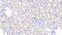 DAB staining on IHC-P; Samples: Rat Kidney Tissue; Primary Ab: 20μg/ml Rabbit Anti-Rat NOS2 Antibody Second Ab: 2µg/mL HRP-Linked Caprine Anti-Rabbit IgG Polyclonal Antibody